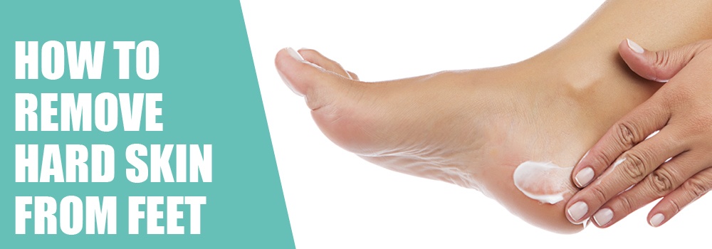How To Get Rid of Hard Skin on Feet